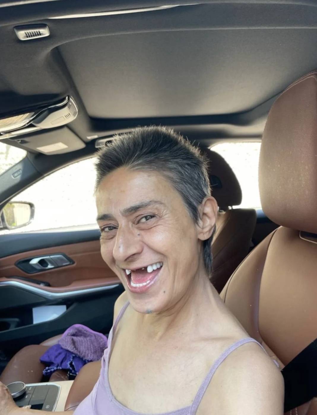 Yıldız Tilbe Dişsiz Fotoğraflarıyla Takipçilerini Şaşırttı! 1