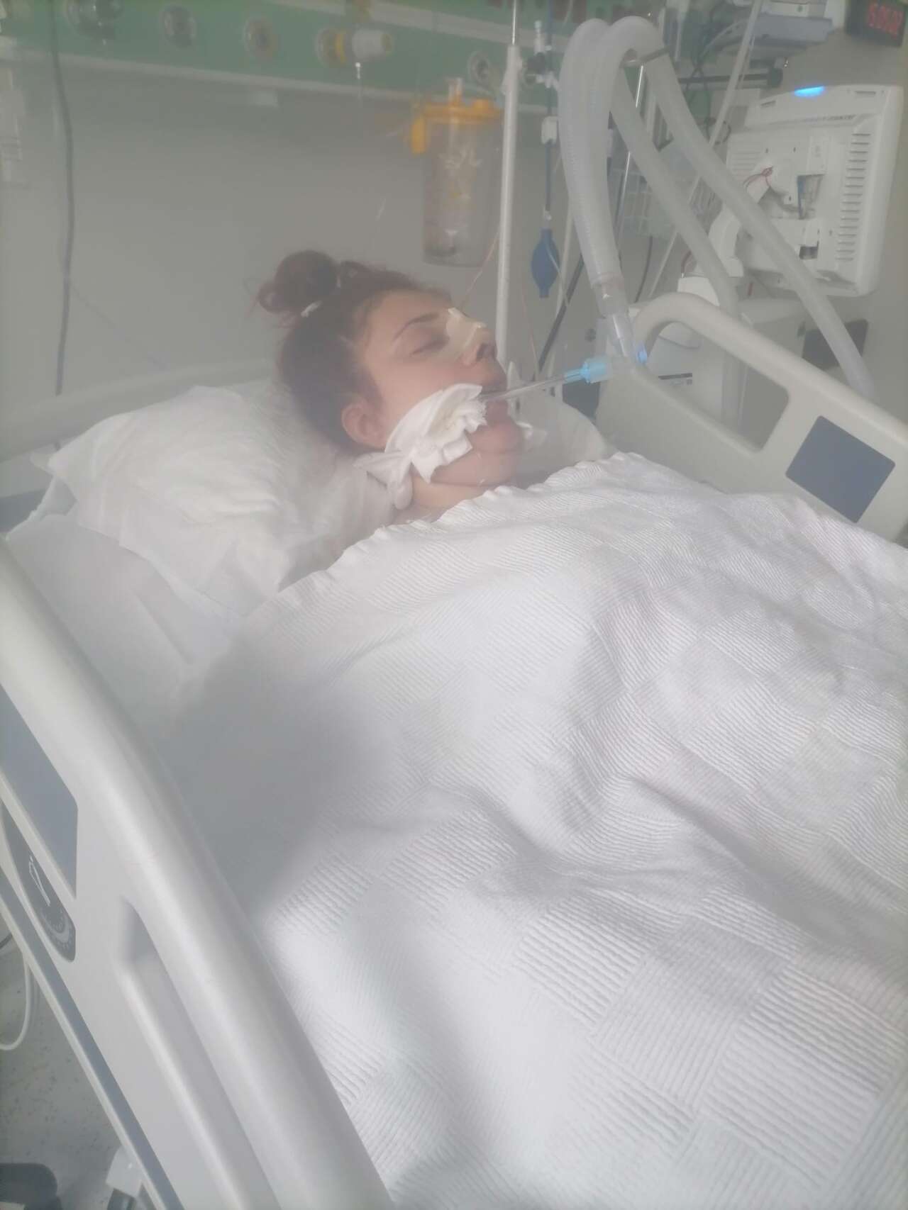 Burun Estetiği İçin Ameliyat Olan 23 Yaşındaki Genç Kız Hayatını Kaybetti 3