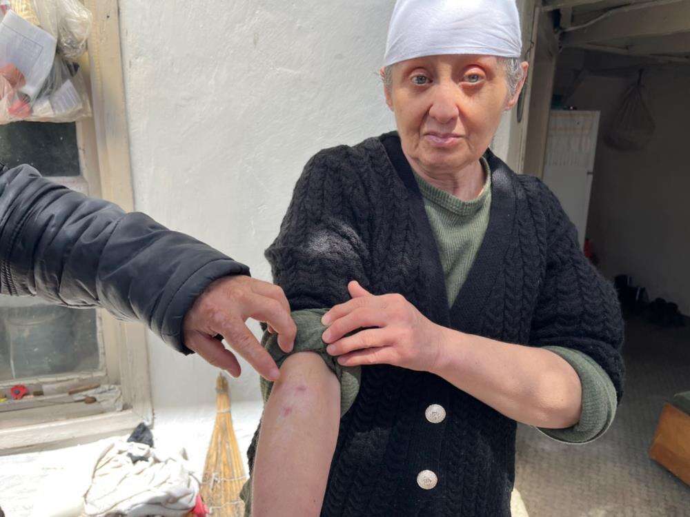 Menteşe’de Evleri Yanan Kardeşler 9 Aydır Destek Bekliyor 3