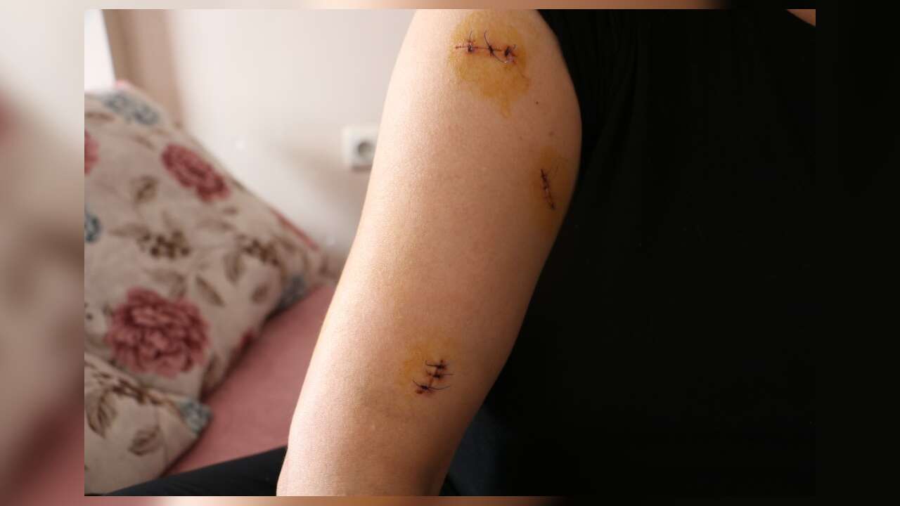 Kocası Tarafından 30 Yerinden Bıçaklandı, Görümcesi Şikayetini Geri Çekmesini İstedi
