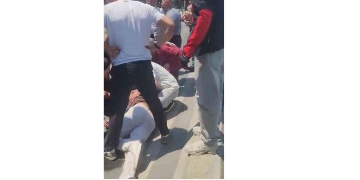 Otobüse Çarpan Skuter Sürücüsü Ağır Yaralandı