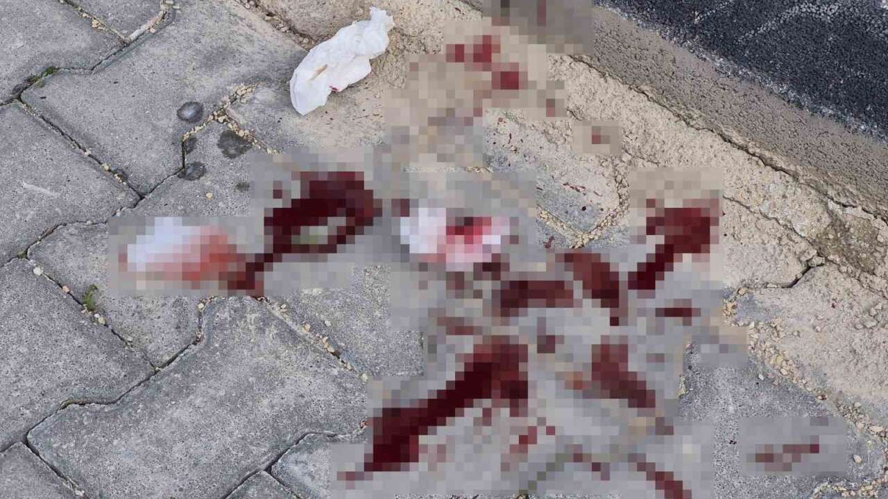 16 Yaşındaki Çocuk Caddede Bacağından Bıçaklandı
