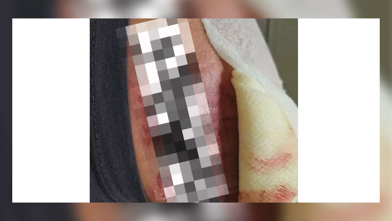 Muğla’da Görev Sırasında Atın Saldırısına Uğrayan Veteriner Hekim Yaralandı