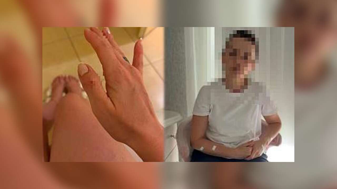 Muğla’da Tatili Kabusa Döndü: Duşakabin Camları Vücuduna Saplandı