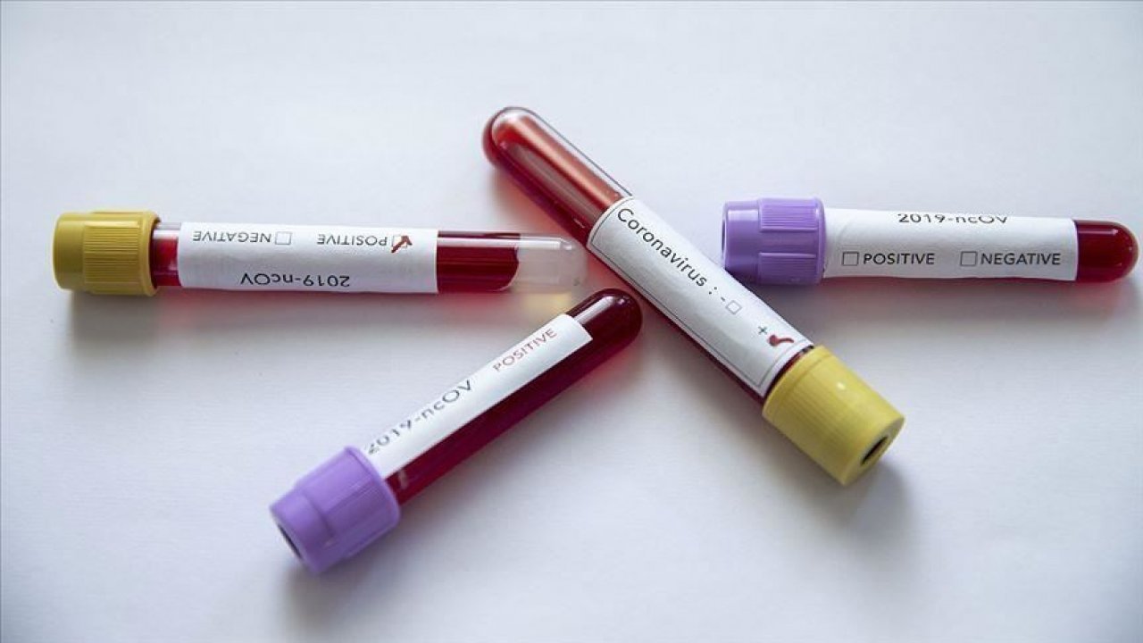 İran'da Sağlık Bakan Yardımcısı koronavirüse yakalandı