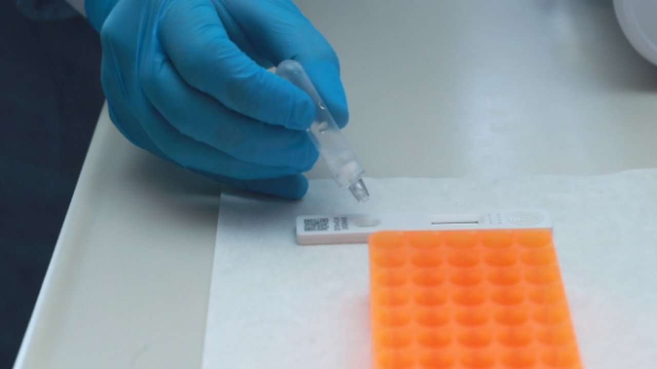 Tıbbi tanı kitlerinin ithalatında uygunluk yazısı talep edilecek