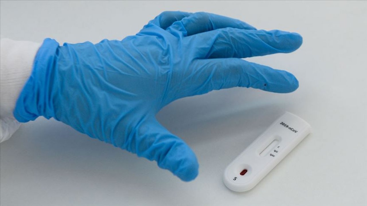 Dünya genelinde Kovid-19 vaka sayısı 2 milyon 200 bini aştı