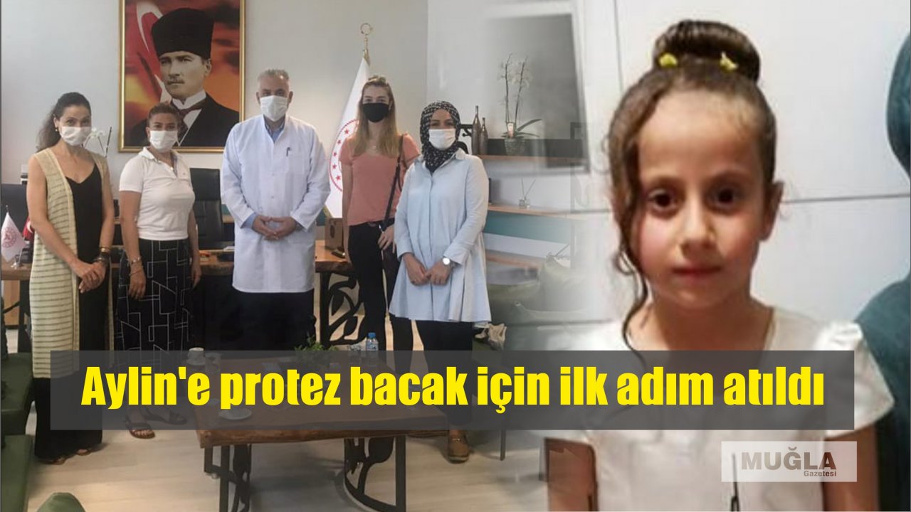 Aylin’e protez bacak için ilk adım atıldı