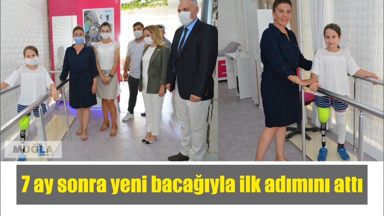 7 ay sonra yeni bacağıyla ilk adımını attı