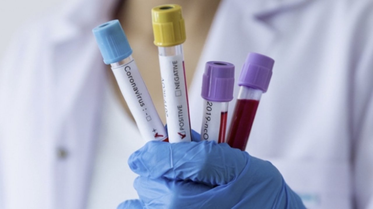 Covid-19 tanısı için yeni sistem