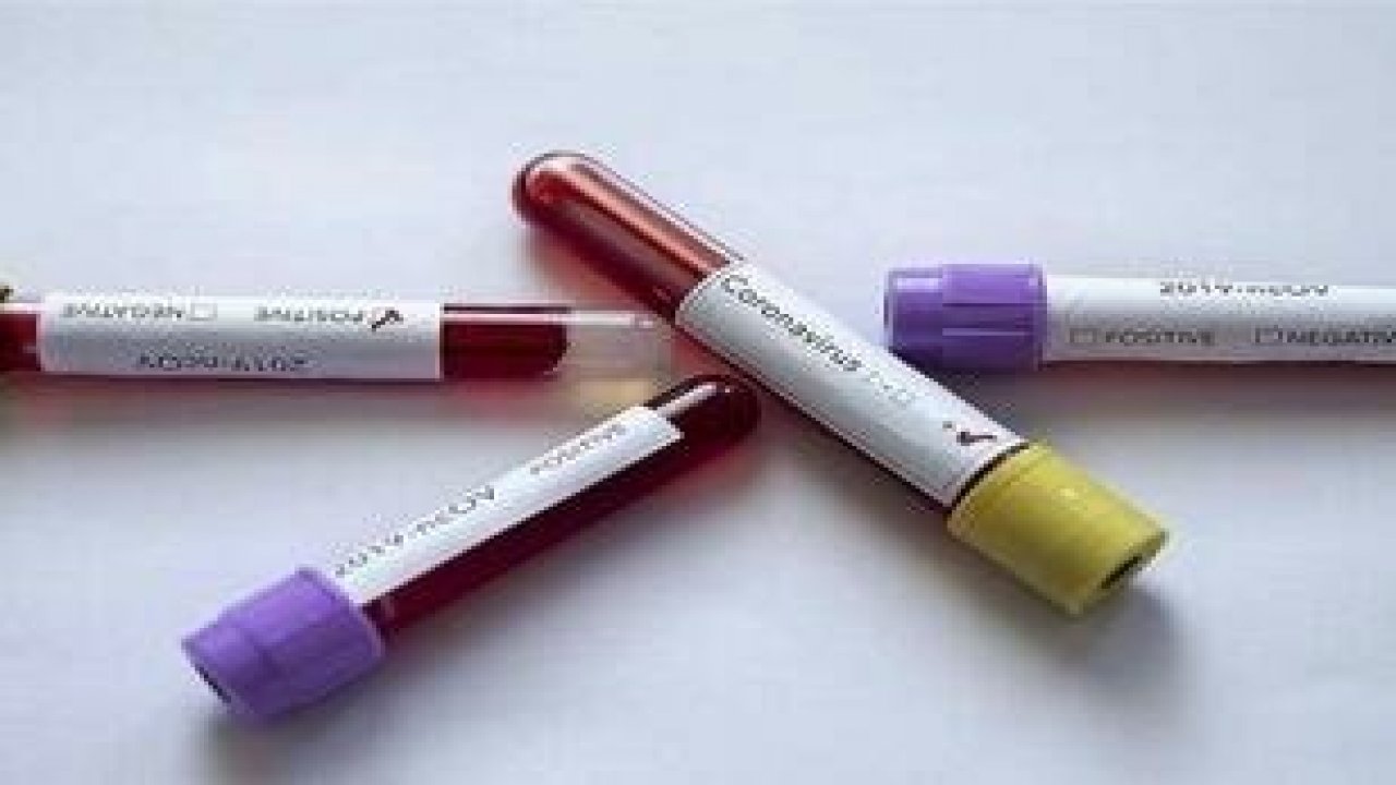 Fethiyespor'da 4 futbolcu ile 1 personelin testi pozitif çıktı