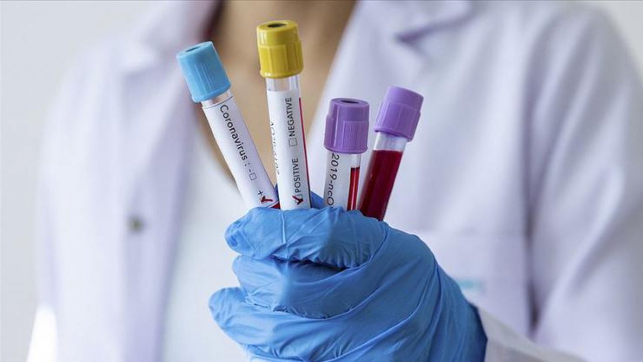 Rakip takımda virüs şoku