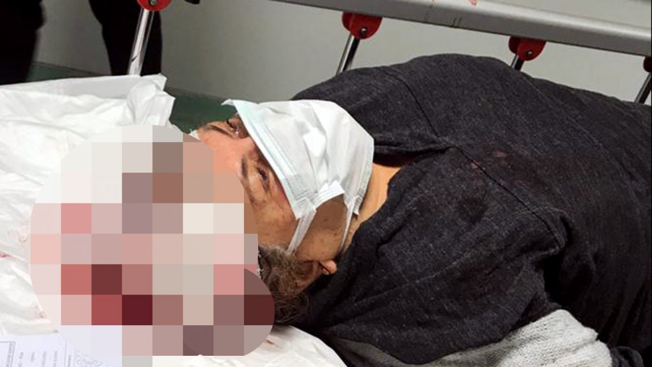 Köpeklerin saldırısına uğrayan kadın ağır yaralandı