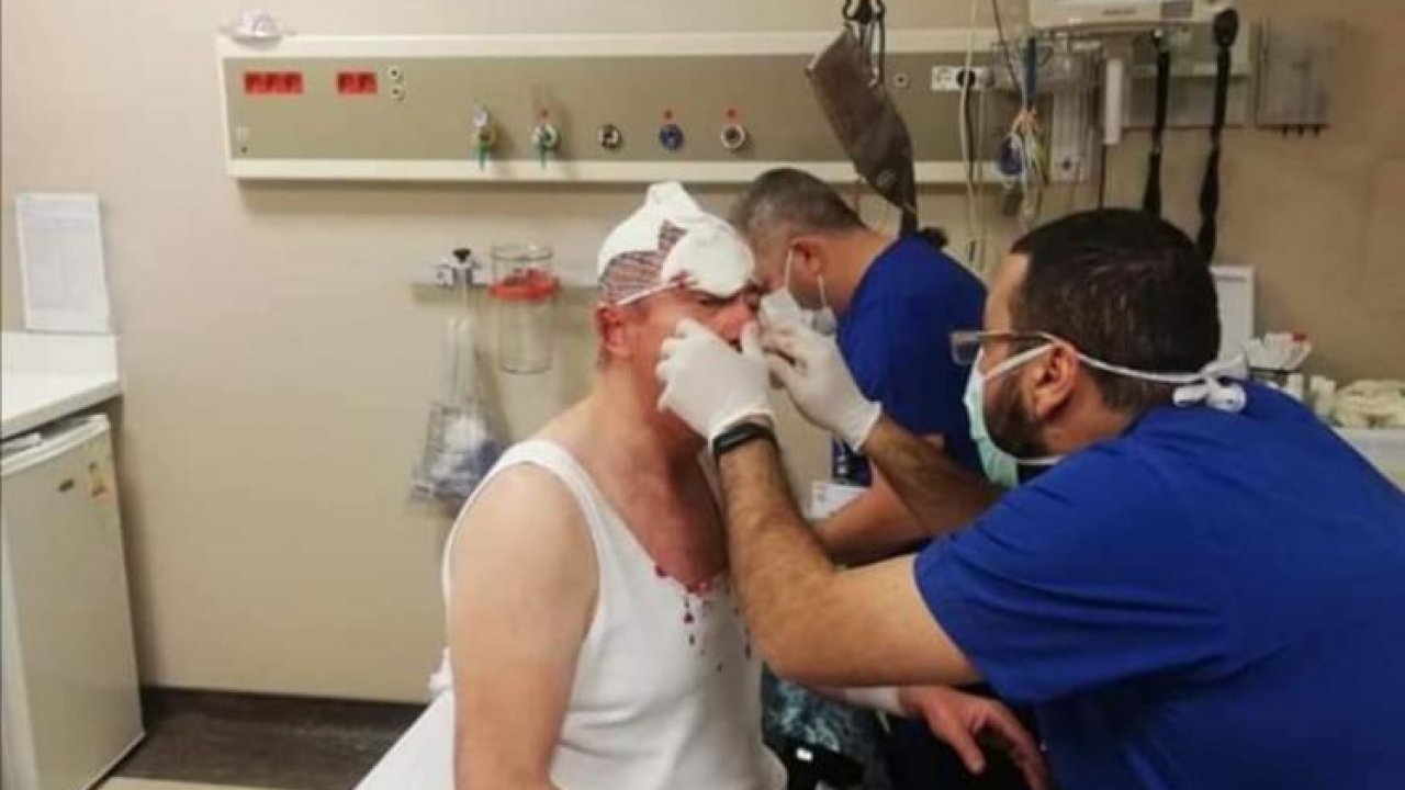 Genel Başkan Yardımcısı Özdağ saldırıya uğradı