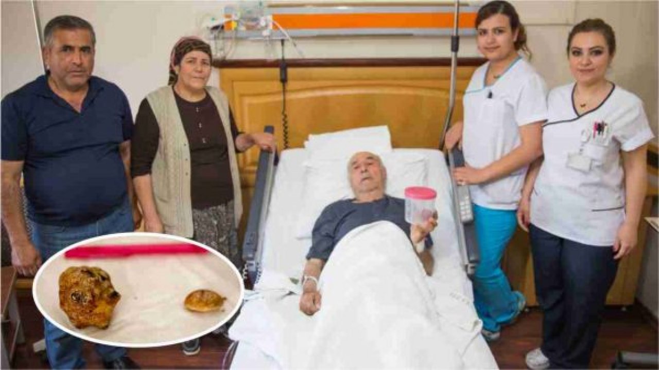 Mesanesinden Portakal Büyüklüğünde Taş Çıkartıldı