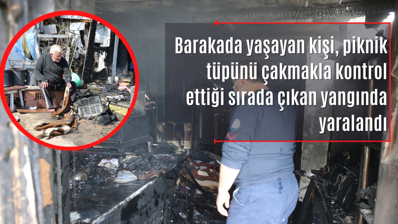 Barakada çıkan yangında yaralandı