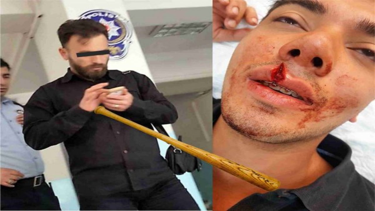 BEYZBOL SOPASI İLE DEHŞET