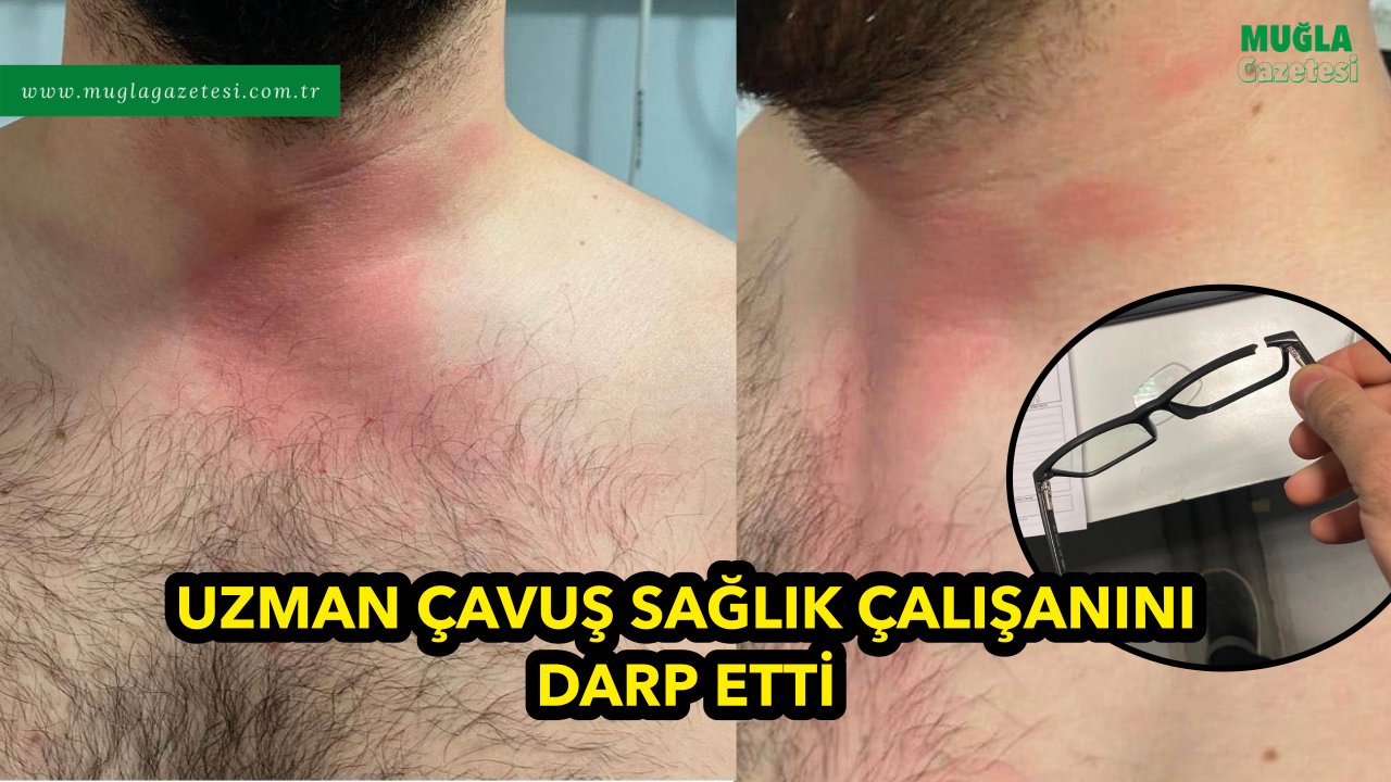 UZMAN ÇAVUŞ ACİL DOKTORU DARP ETTİ