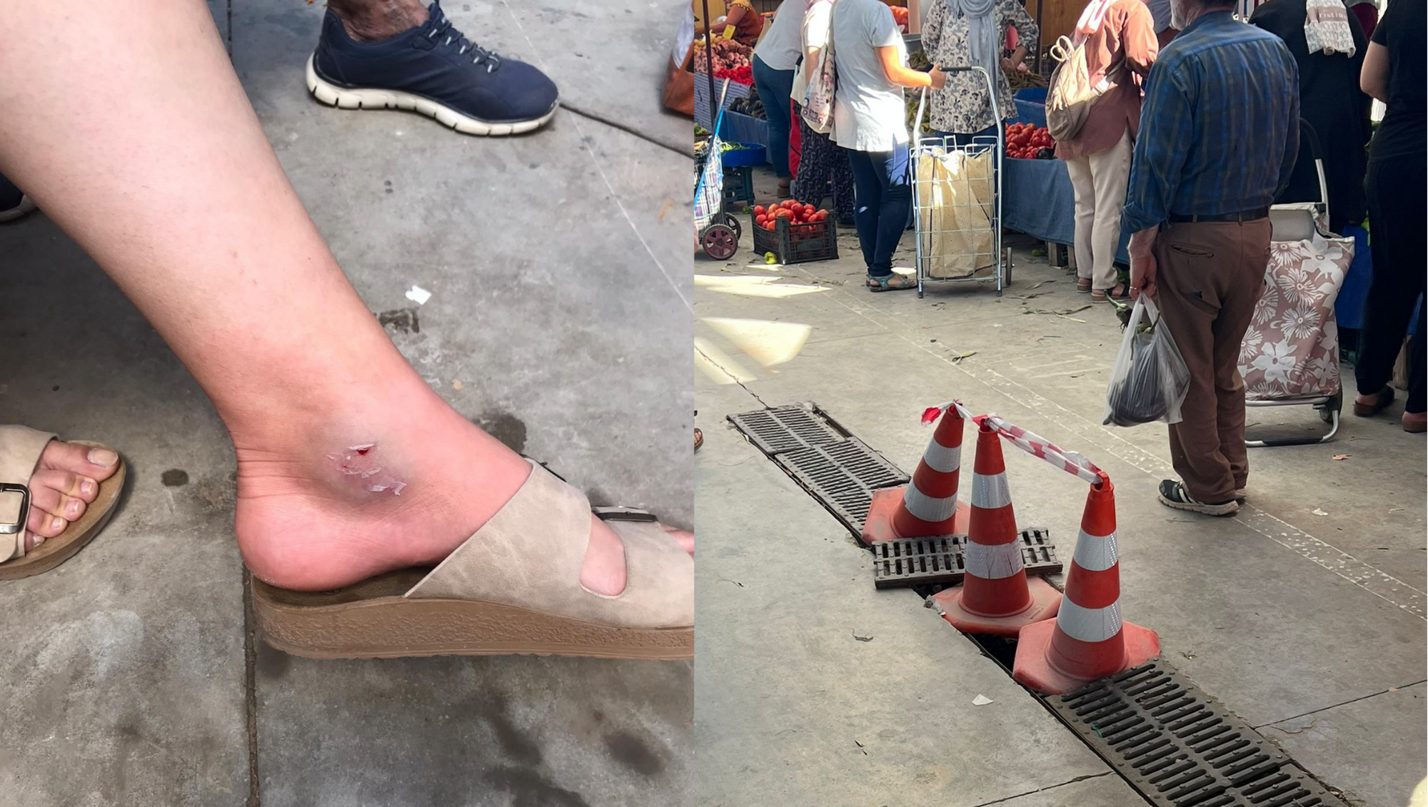 AYAĞI MAZGALA SIKIŞTI