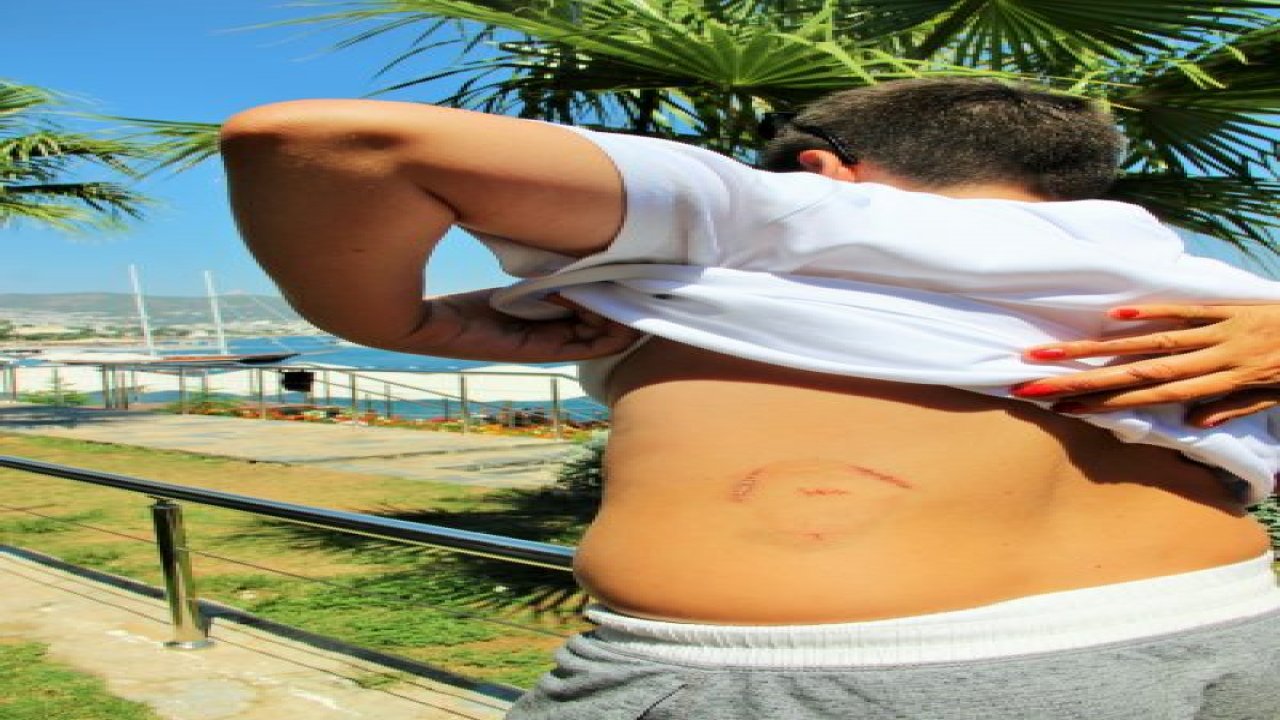 Caretta caretta saldırısı