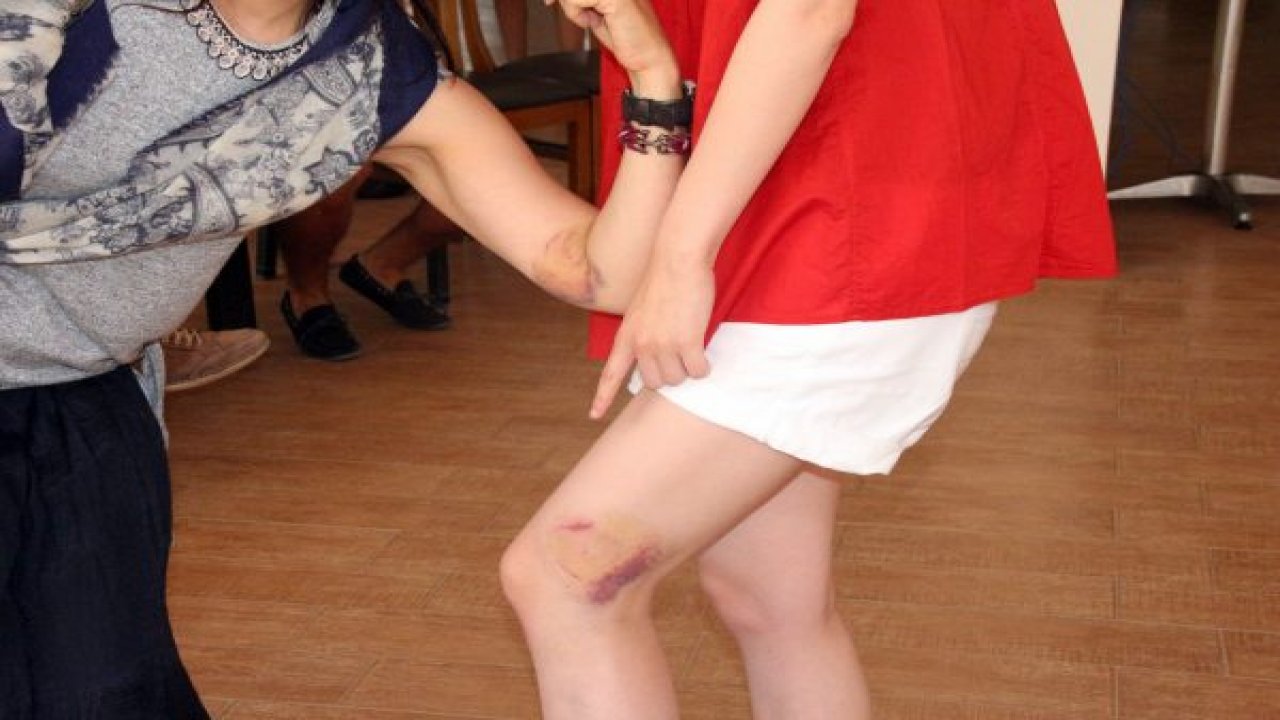 Caretta caretta Japonlara saldırdı