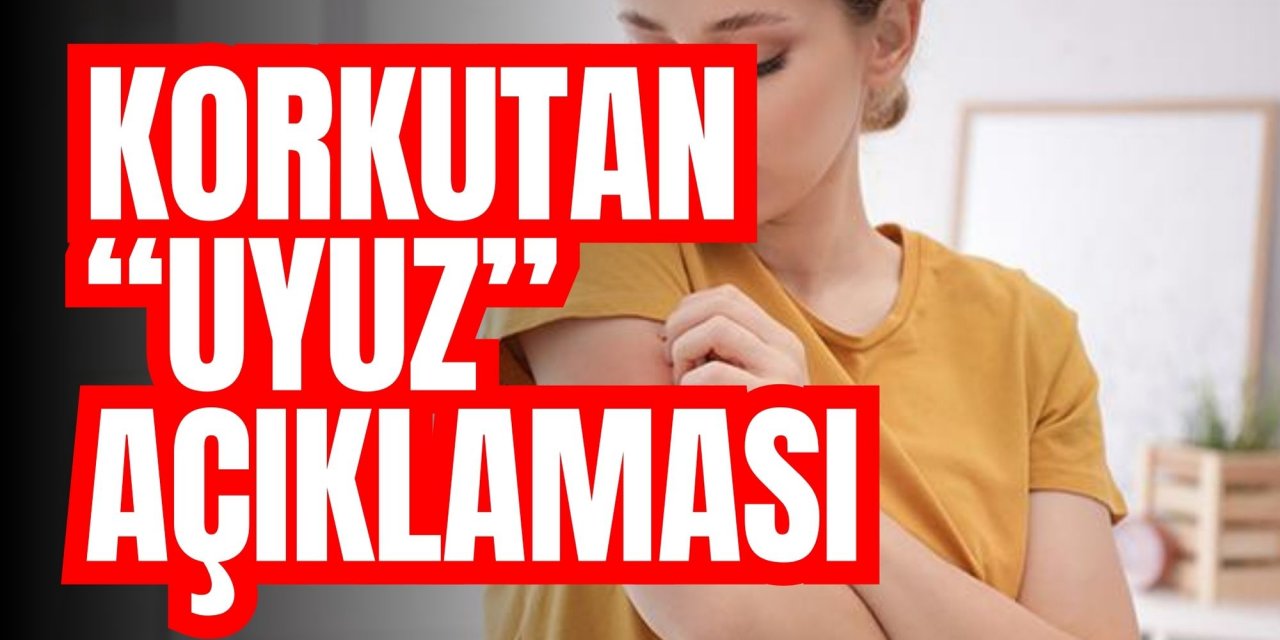 Korkutan “uyuz” açıklaması