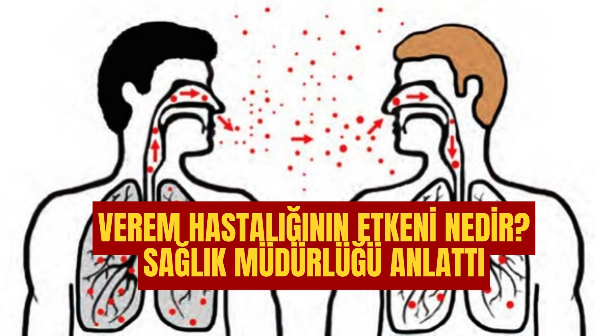 Verem Hastalığının Etkeni Nedir? Sağlık Müdürlüğü Anlattı