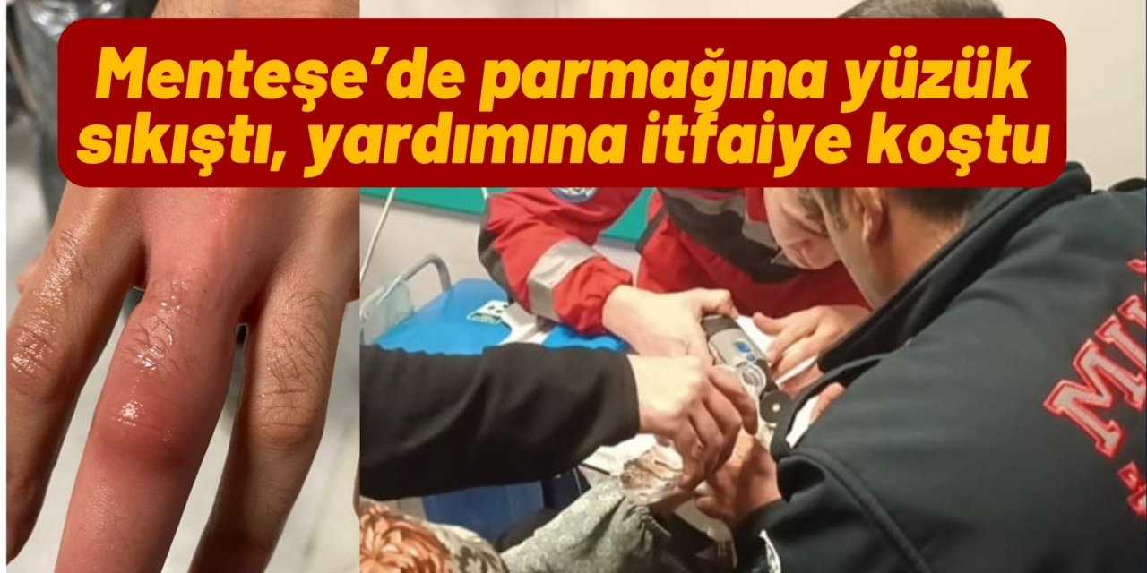 Menteşe’de parmağına yüzük sıkıştı, yardımına itfaiye koştu
