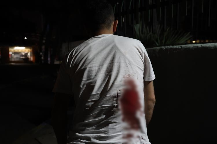 Taksicinin sırtına makas saplayan zanlı tutuklandı