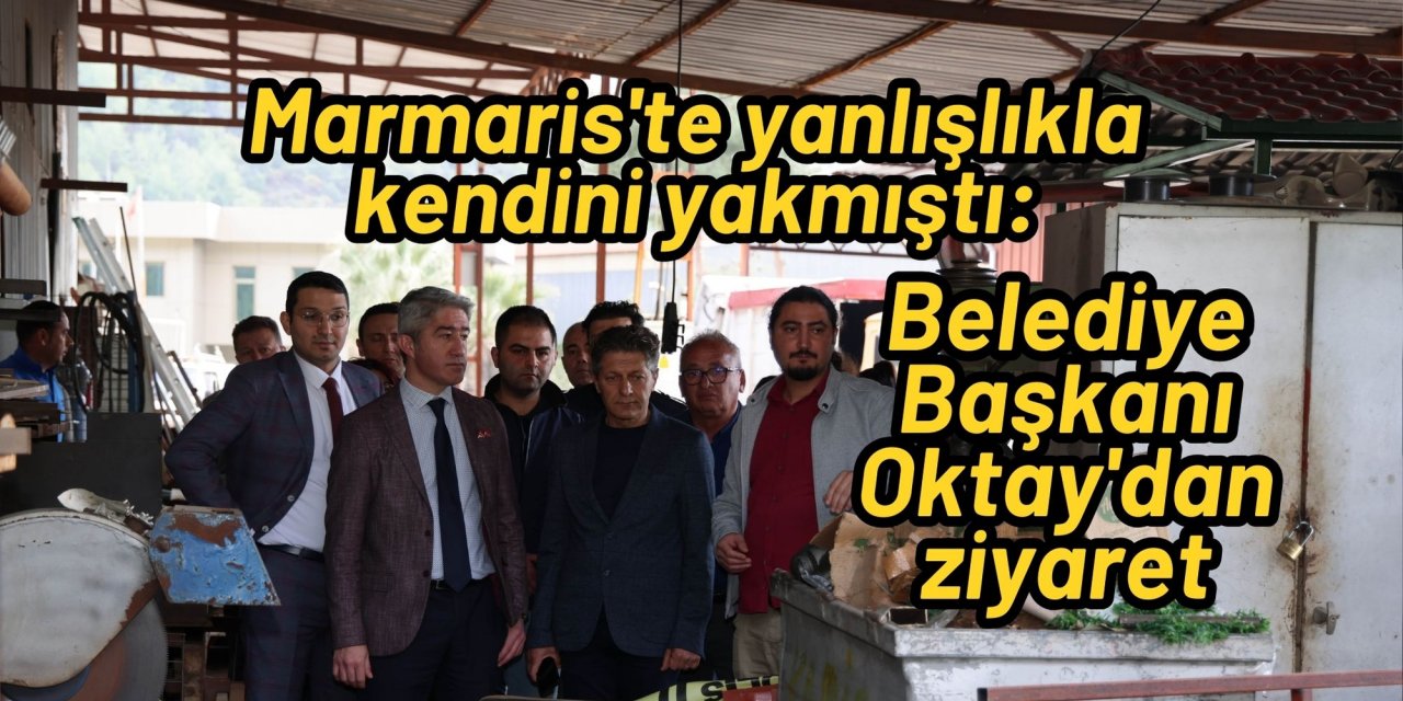 Marmaris'te yanlışlıkla kendini yakmıştı: Belediye Başkanı Oktay'dan ziyaret