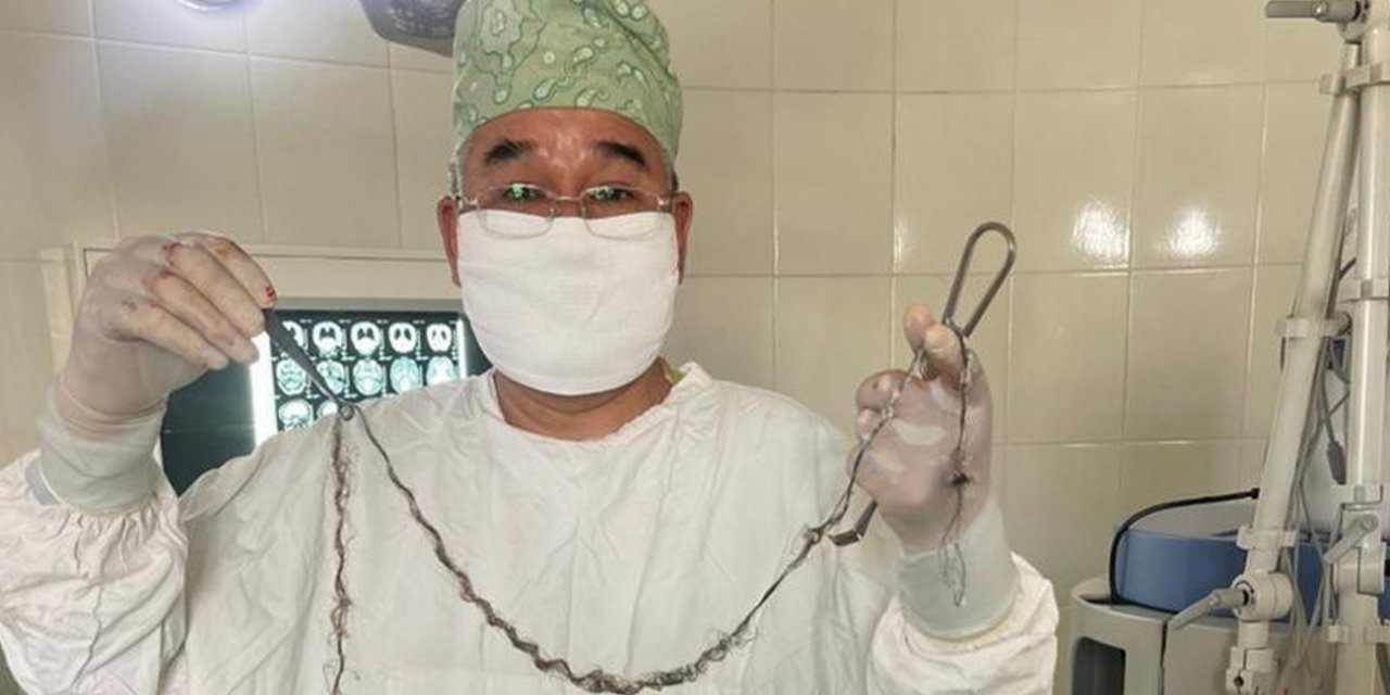 Çocuğun beyninden saç çıktı