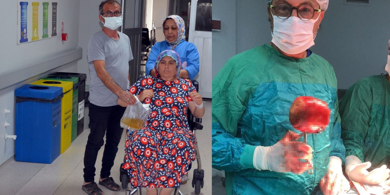Doktorlar bile inanamadı: Ağrı şikayetiyle gitti, mesanesinden çıkan şey şok etti