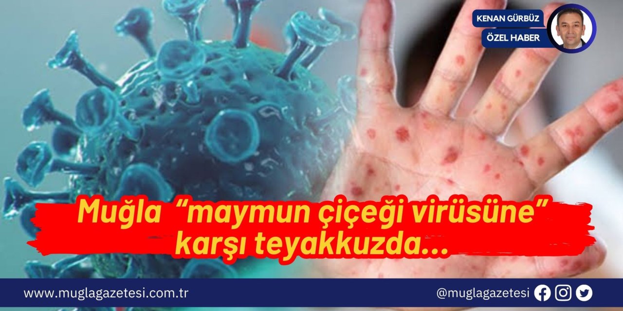 Muğla  “maymun çiçeği virüsüne” karşı teyakkuzda…