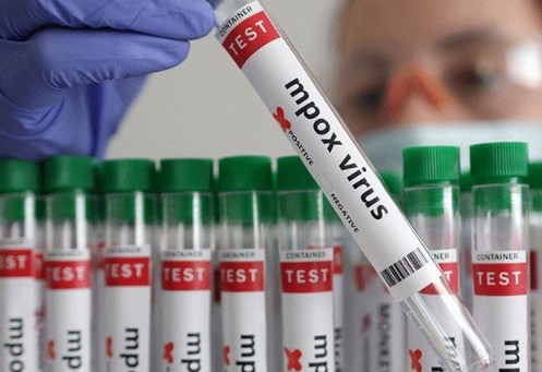 Maymun çiçeği (mpox): Mevcut vakaların çoğu çocuk!