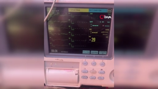 Cenaze namazı kılınırken yaşadığı belirlenmişti: Nabzının attığı görüntüler ortaya çıktı