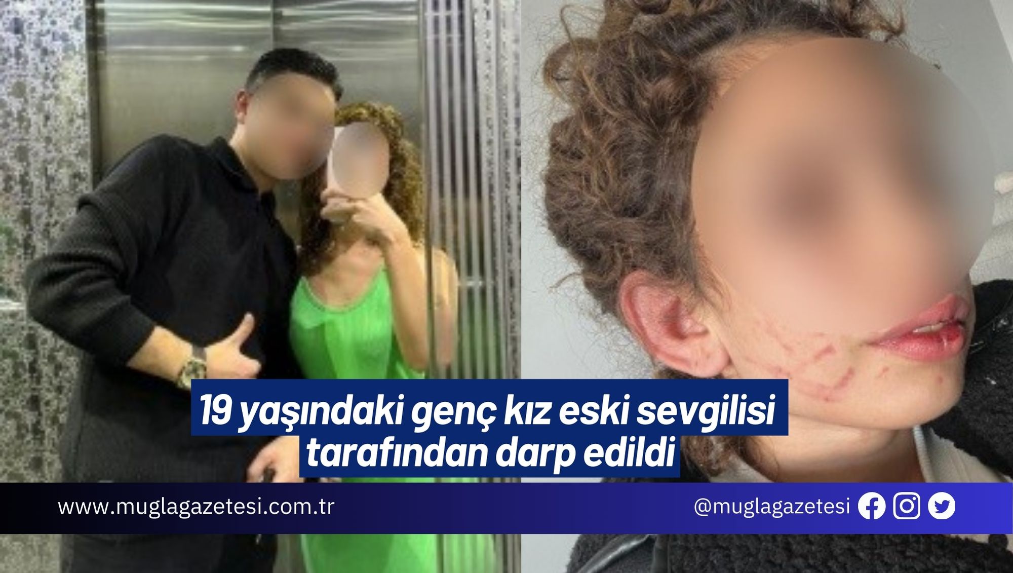 19 yaşındaki genç kız eski sevgilisi tarafından darp edildi