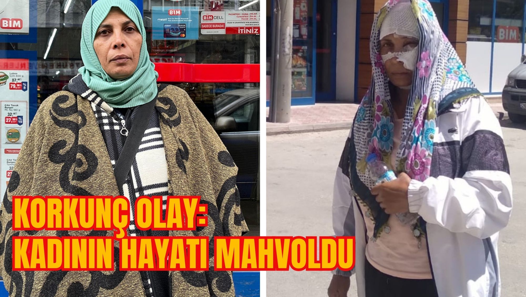 KORKUNÇ OLAY: KADININ HAYATI MAHVOLDU