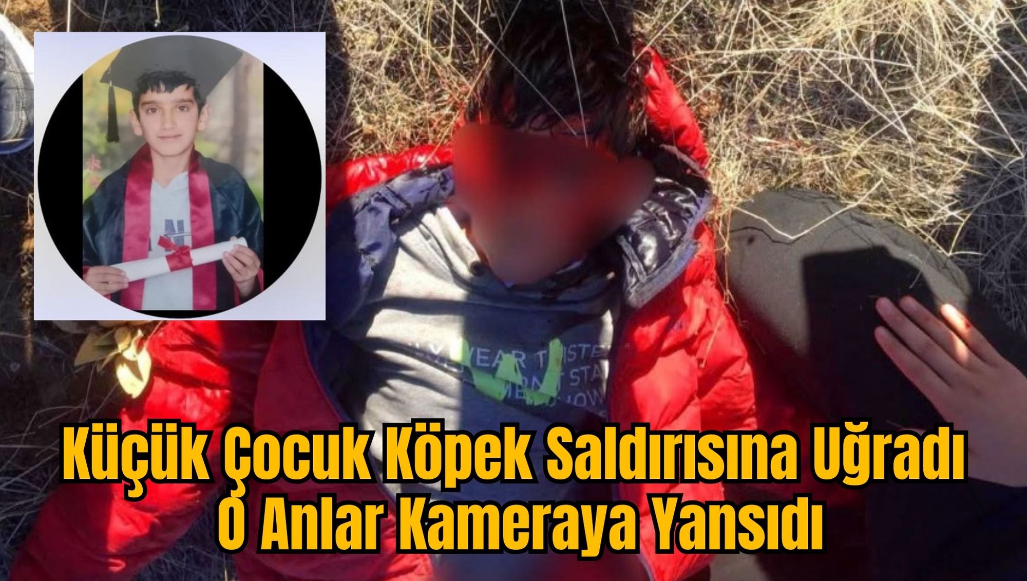 Küçük Çocuk Köpek Saldırısına Uğradı, O Anlar Kameraya Yansıdı
