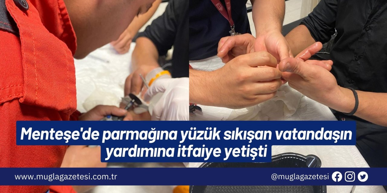 Menteşe'de parmağına yüzük sıkışan vatandaşın yardımına itfaiye yetişti