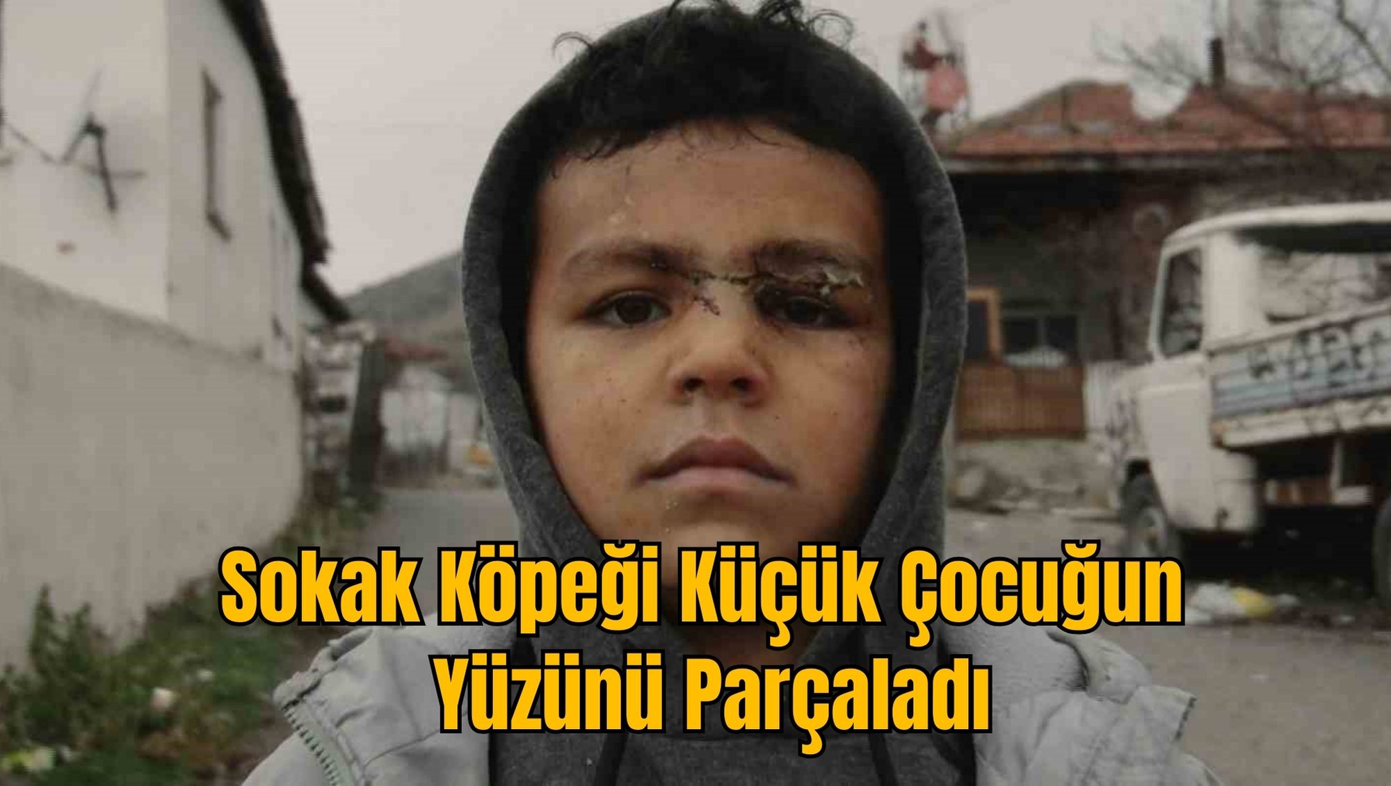 Sokak Köpeği Küçük Çocuğun Yüzünü Parçaladı