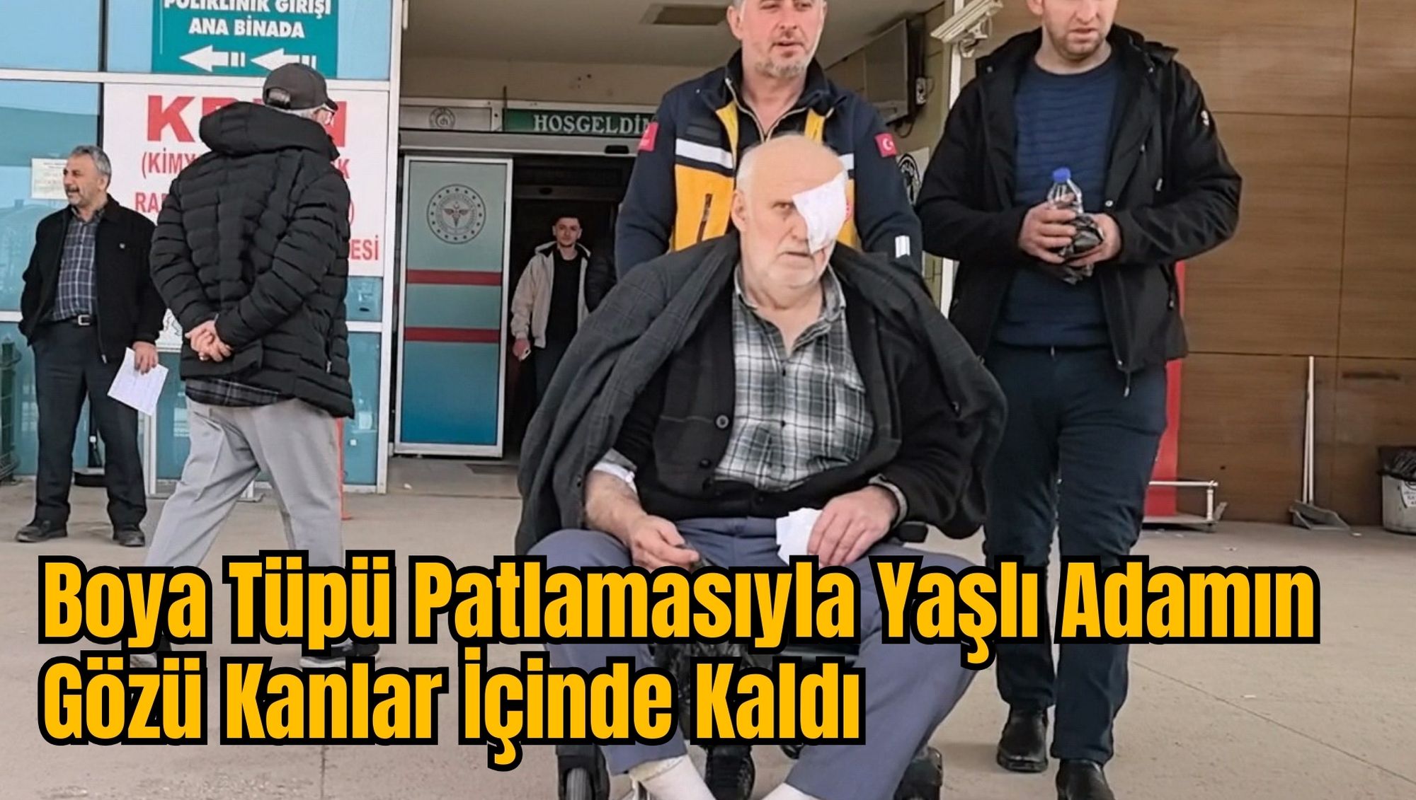 Boya Tüpü Patlamasıyla Yaşlı Adamın Gözü Kanlar İçinde Kaldı