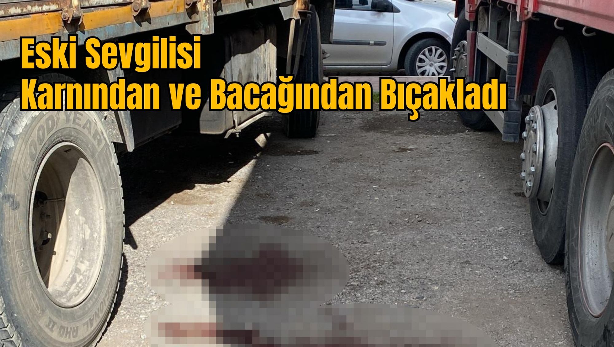 Eski Sevgilisi Karnından ve Bacağından Bıçakladı