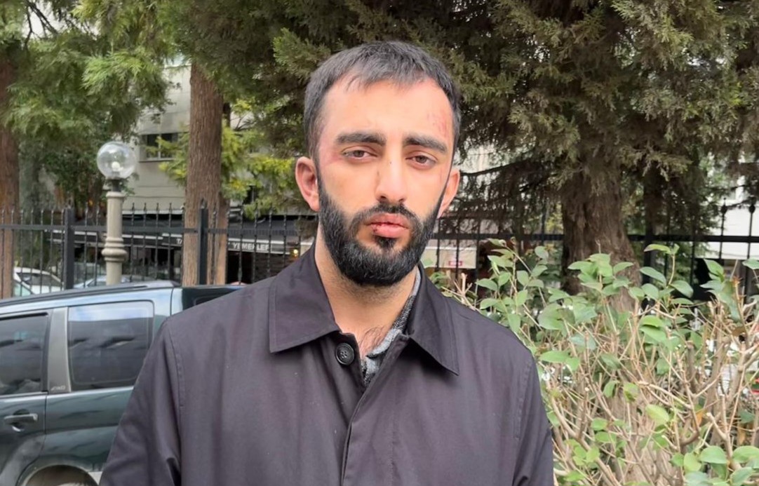 Çocuğuna Bez Almaya Giden Vatandaş Başıboş Köpeklerin Saldırısına Uğradı