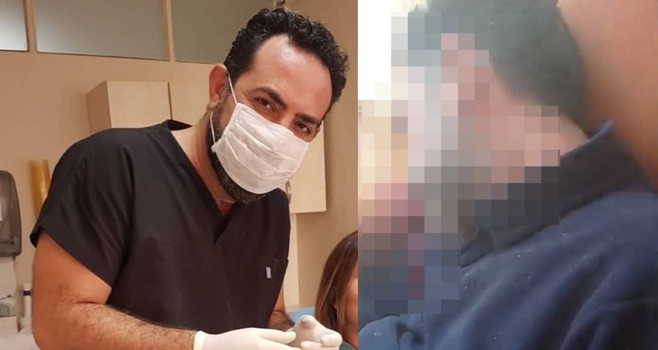 Kan Donduran Olay: Diş Hekimini Başından Vurdu Videosunu Annesine Yolladı