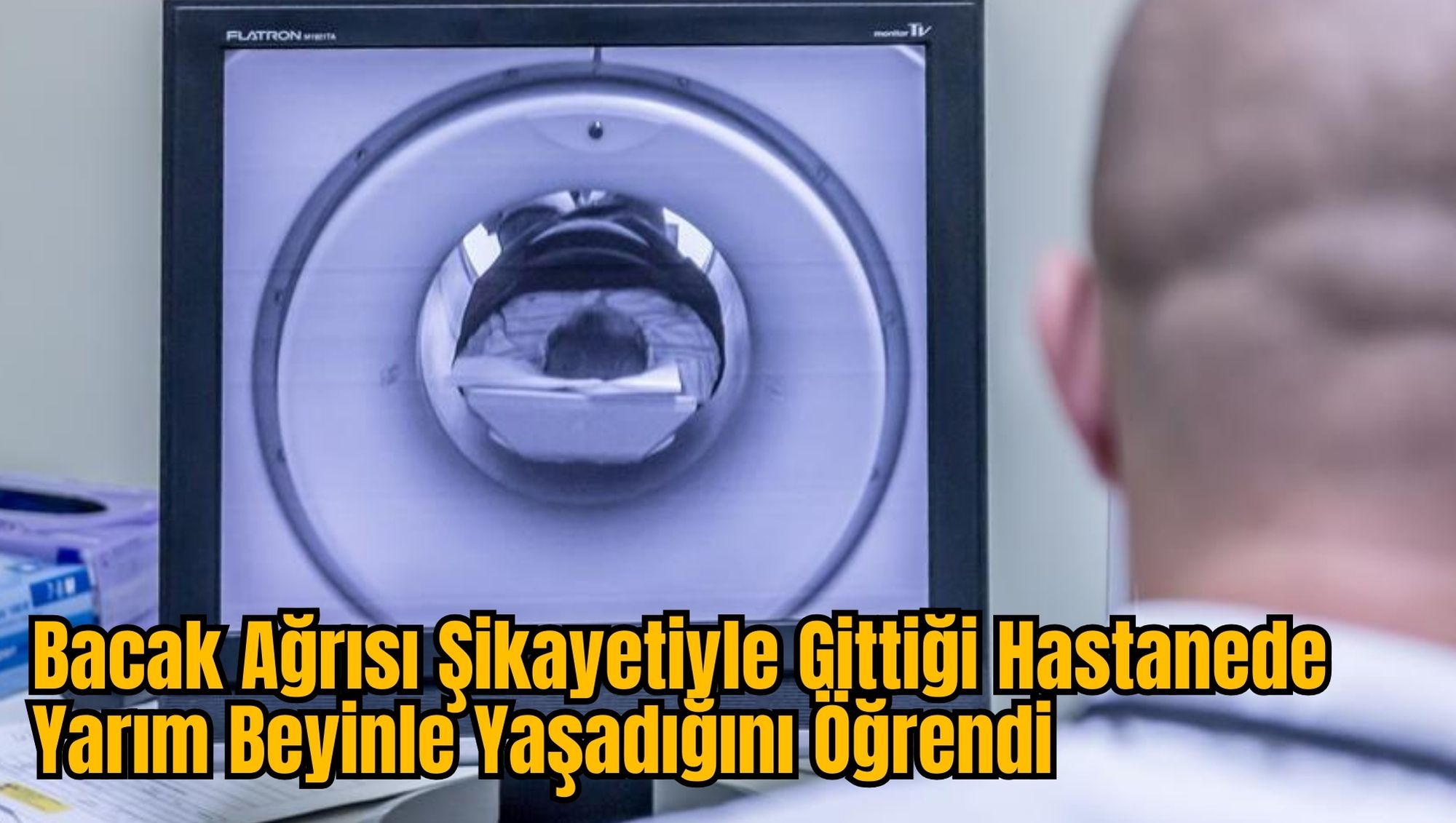 Bacak Ağrısı Şikayetiyle Gittiği Hastanede Yarım Beyinle Yaşadığını Öğrendi