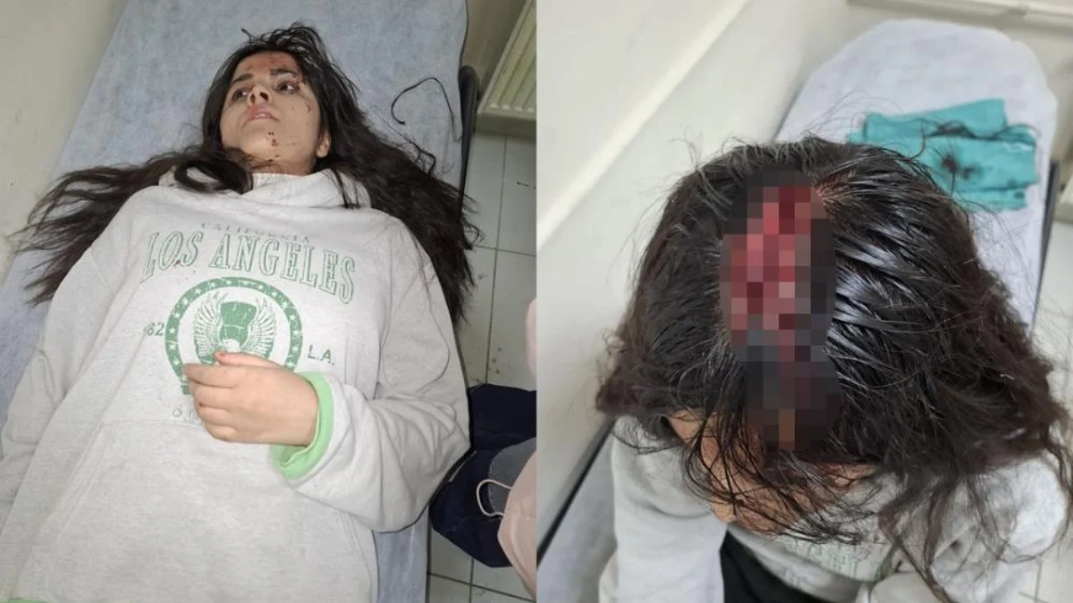 Genç Kızın Kafasına Buz Kütlesi Düştü