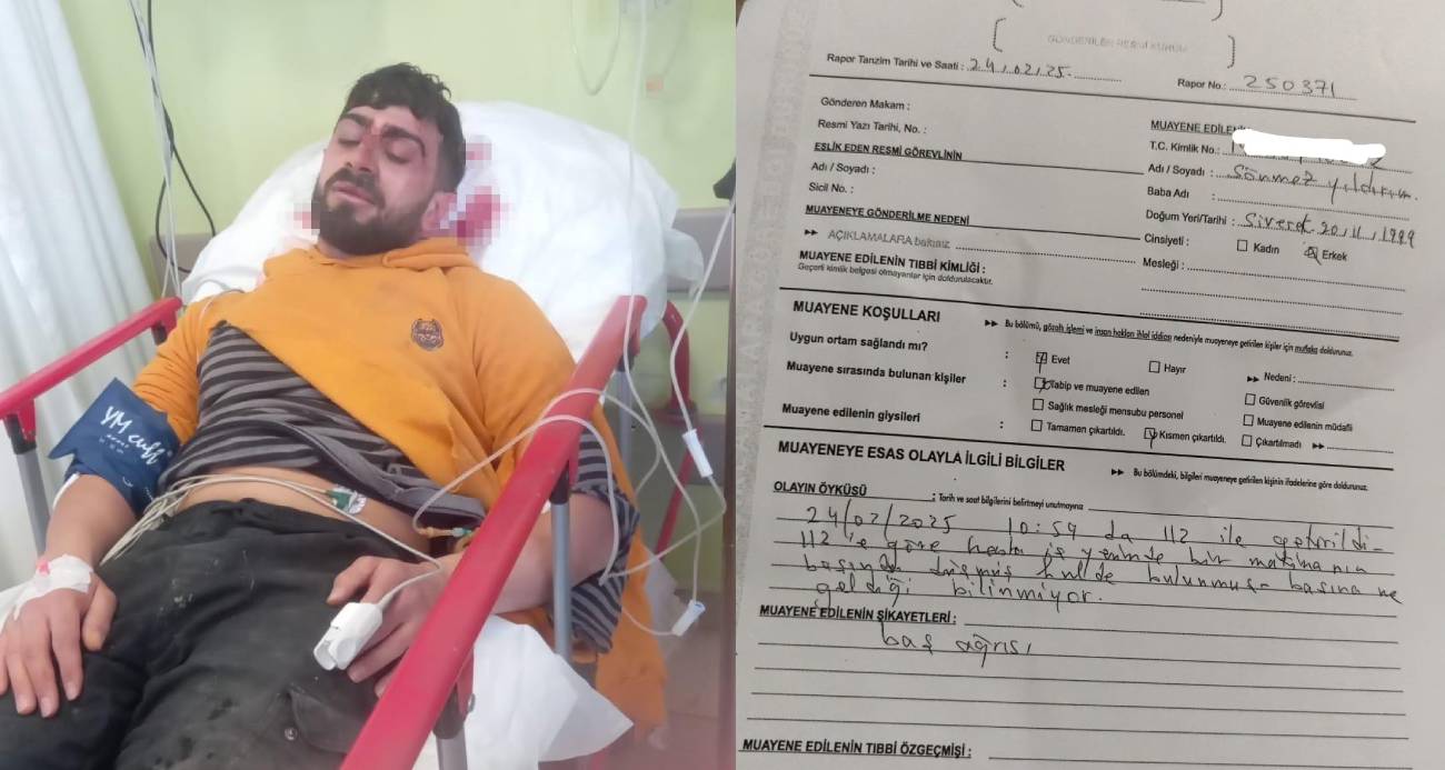 Skandal Rapor: 35 Dikişlik Yaraya 'Baş Ağrısı' Denildi