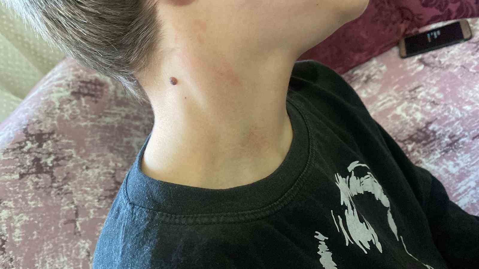 Öğretmenden Öğrenciye Şiddet İddiası