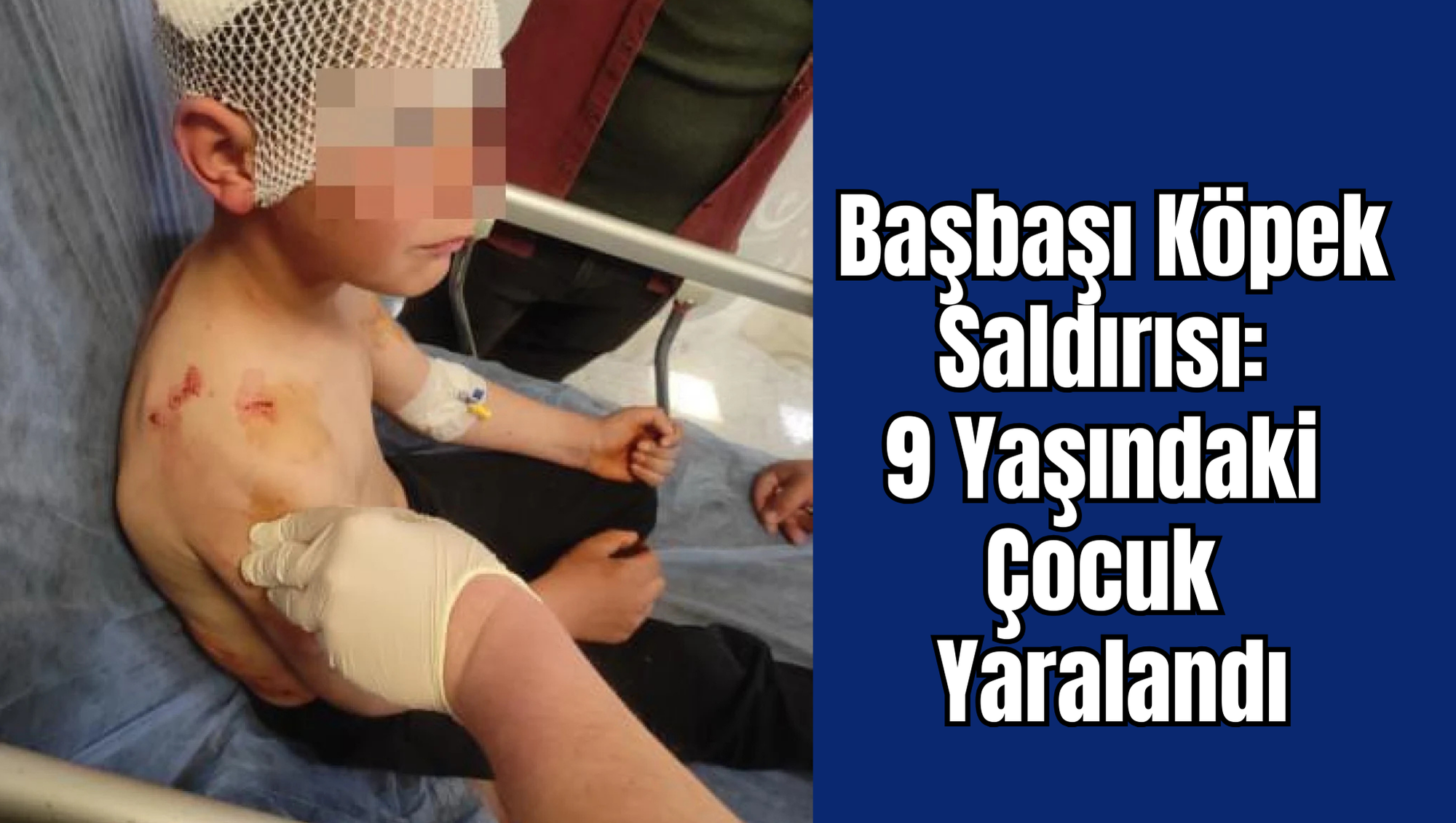 Başbaşı Köpek Saldırısı: 9 Yaşındaki Çocuk Yaralandı