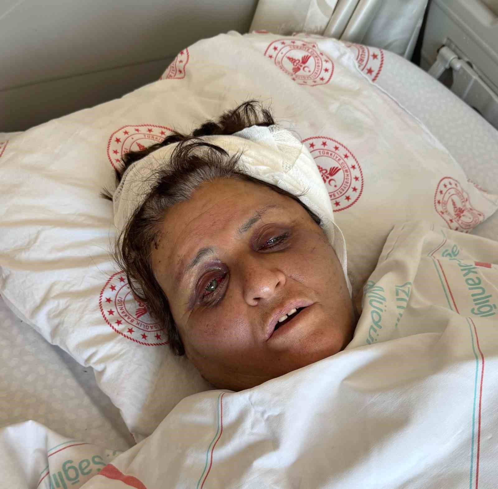 Yufka Yüzünden Gelini Tarafından Tuğlayla Dövülüp Komalık Olmuştu...